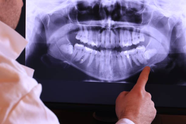 Best Emergency Dental Extractions in Hyde Rk, PA